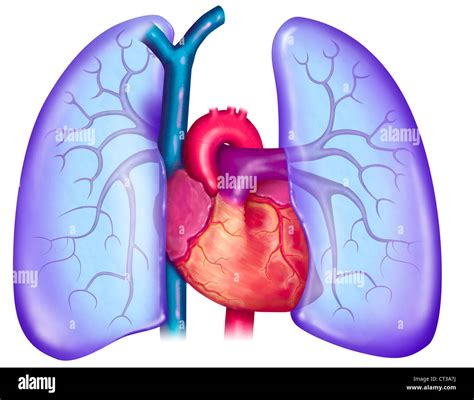 cardio pulmonar - o que é embolia pulmonar